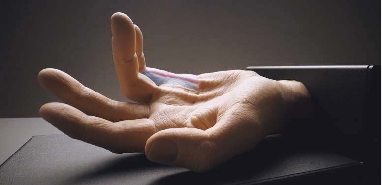 The Dupuytren's Contracture Injection Simulator for XIAFLEX® training