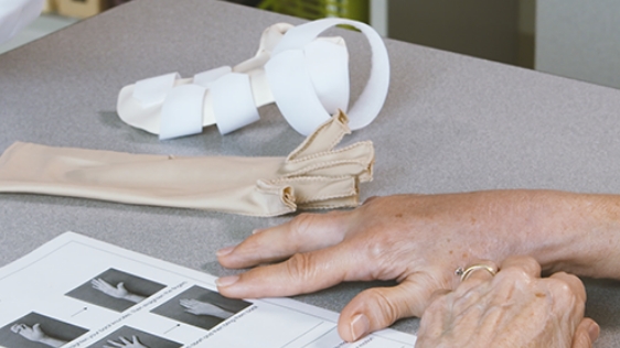 Counseling being provided to a Dupuytren's contracture patient following XIAFLEX® treatment