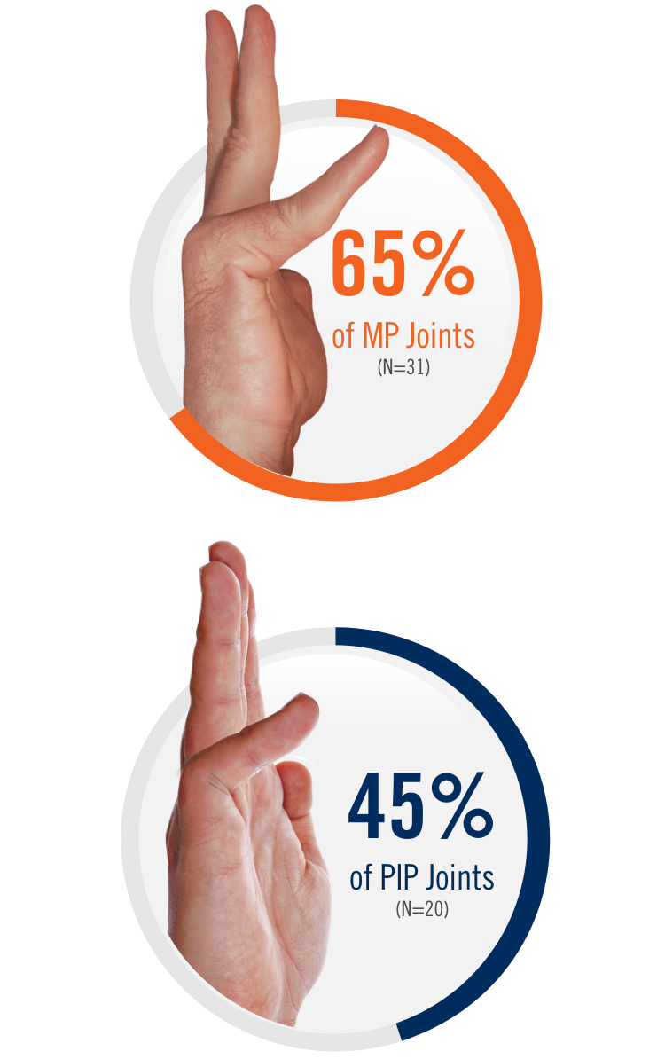 65% of MP joints and 45% of PIP joints