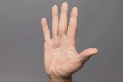 Palm after treatment