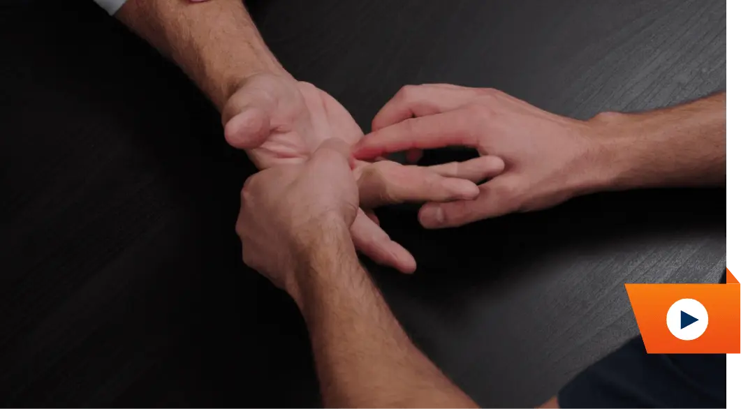 Watch treatment hands comparison video