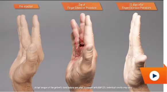 Watch recovery hands video