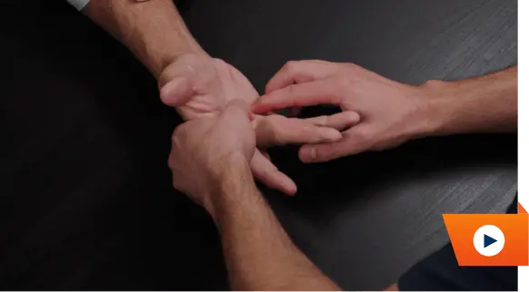 Watch treatment hands comparison video