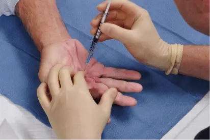 Hand treatment
