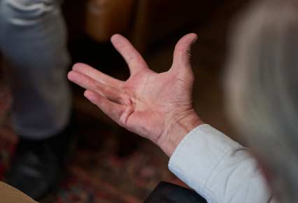 Dupuytren’s contracture patient with open palm and one bent finger