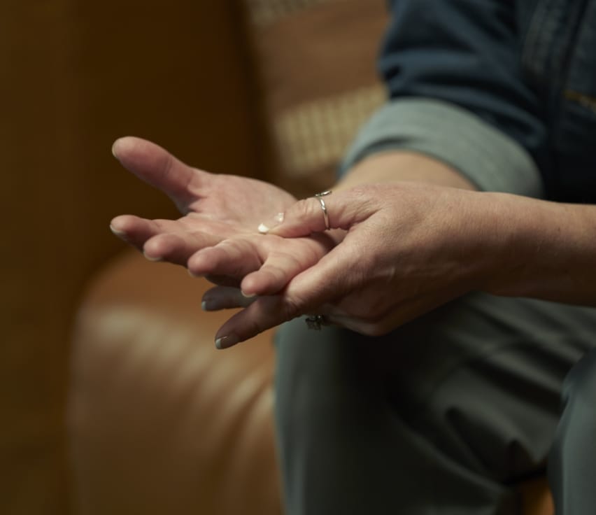 Dupuytren’s contracture patient with left hand rubbing open right palm