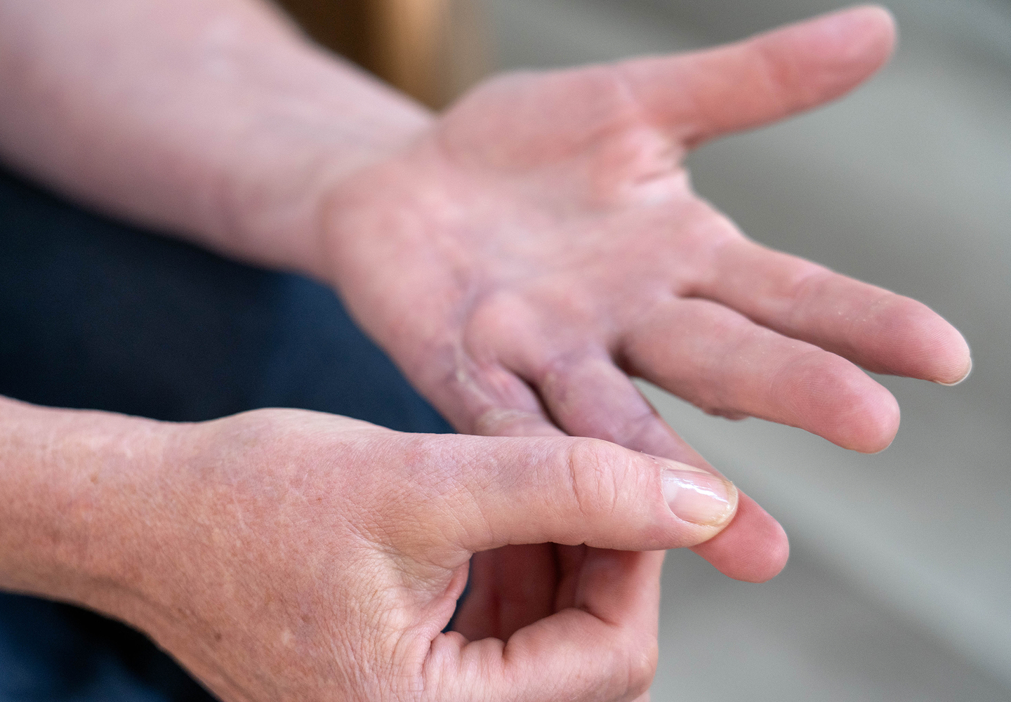 Patient with open palms